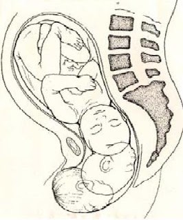 Fisioterapia obstétrica: Preparación al parto