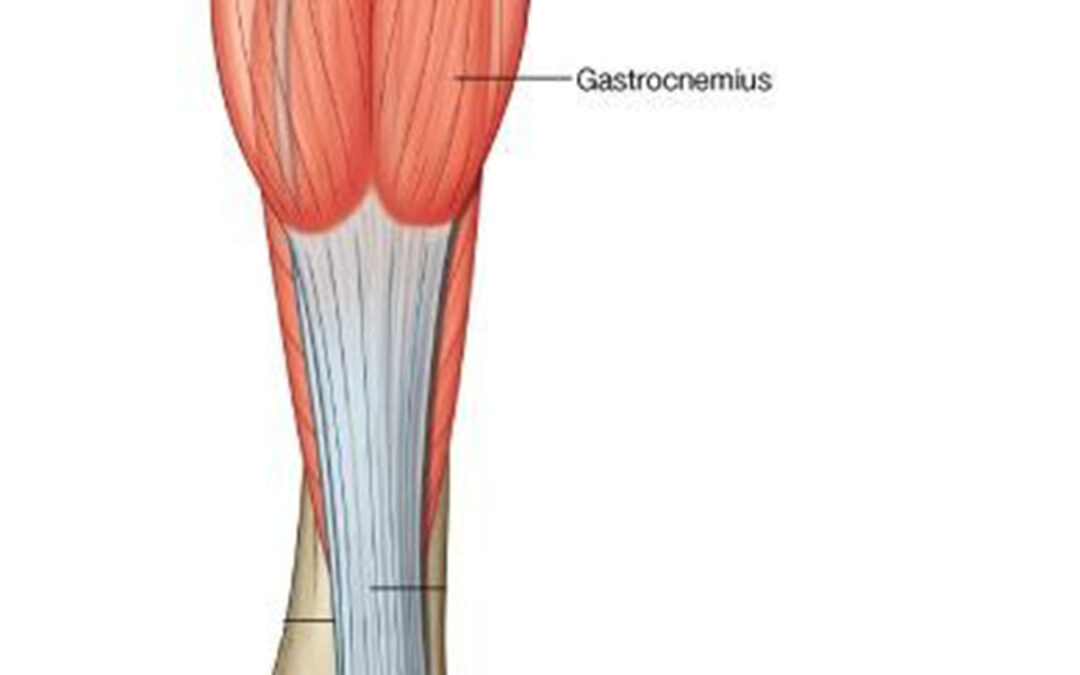 Músculo sóleo: anatomía patológica