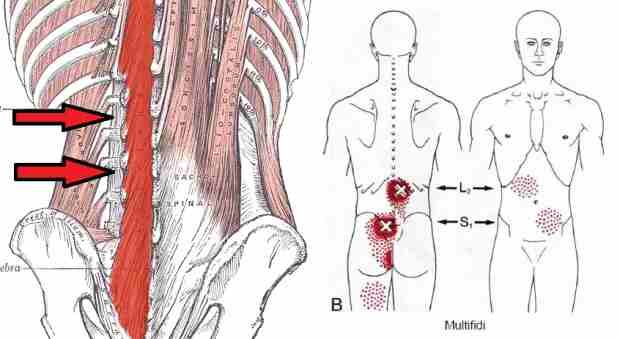 Fisioterapia en la lumbalgia: anatomía de los músculos multífidos lumbares