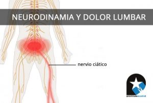neurodinamia-dolor-lumbar