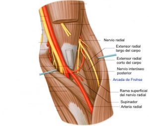 Epicondilalgia lateral y nervio radial