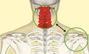 Tendinopatía del manguito rotador y su relación con la columna cervical